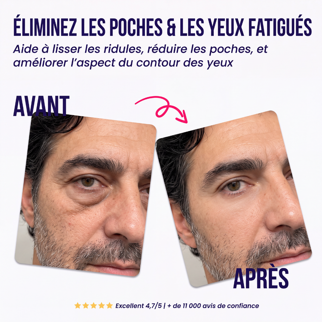 Patchs yeux à micro-aiguilles